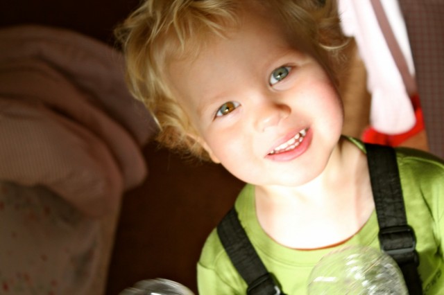 Iako je veoma rijetka pojava, može se desiti da Vaše dijete ima različitu boju lijevog i desnog oka.